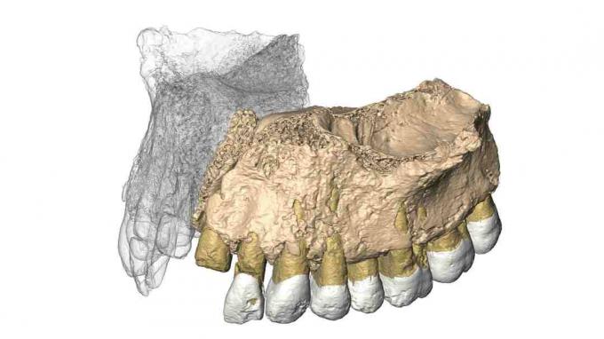 Mislaya Maxilla reconstruída