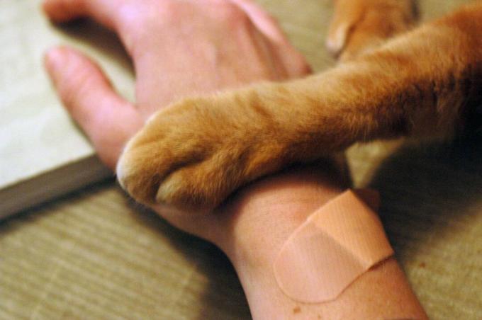 Uma mão humana enfaixada e a pata de um gato.