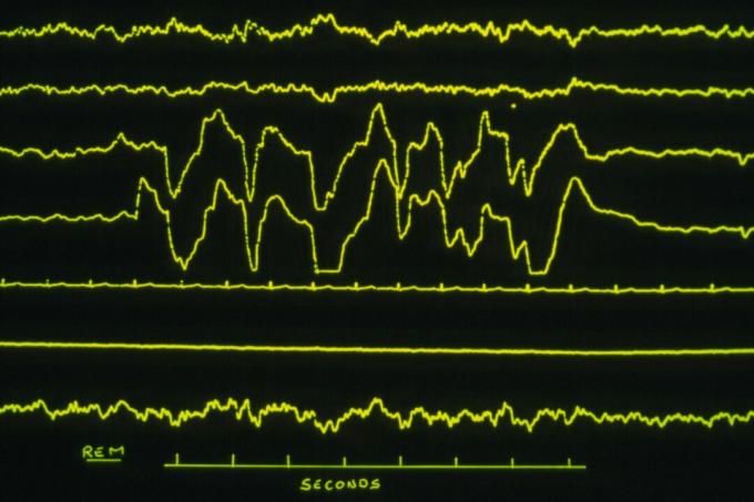 O sono REM
